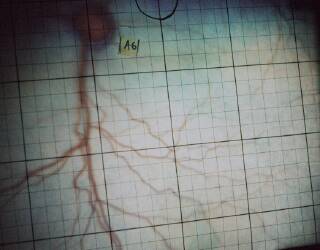 The retina of the cat.